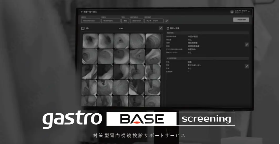 AIメディカルサービス、検診業務をクラウドでDX化する 対策型胃内視鏡検診サポートサービス「gastroBASE screening」をリリース　#IVSPRWeek