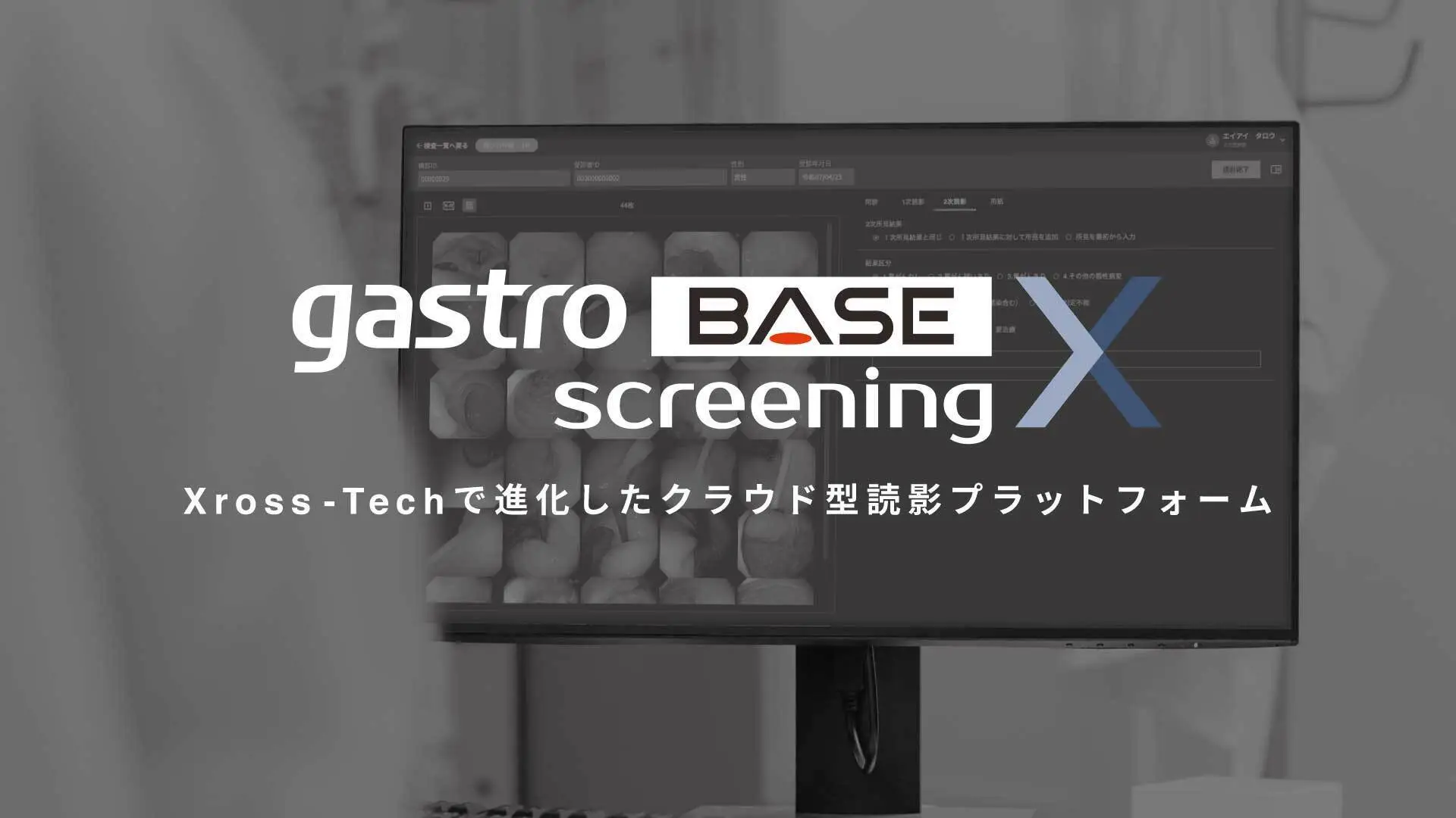 AIメディカルサービス、対策型胃がん検診および対策型肺がん検診において医師および運用上の負担を軽減するクラウド型読影プラットフォームの製造販売認証を取得　