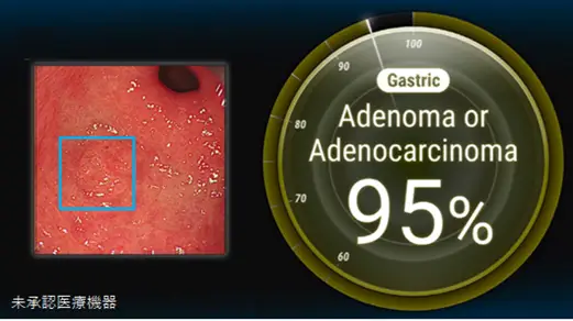世界初の胃がん鑑別AIを医療機器製造販売承認申請いたしました