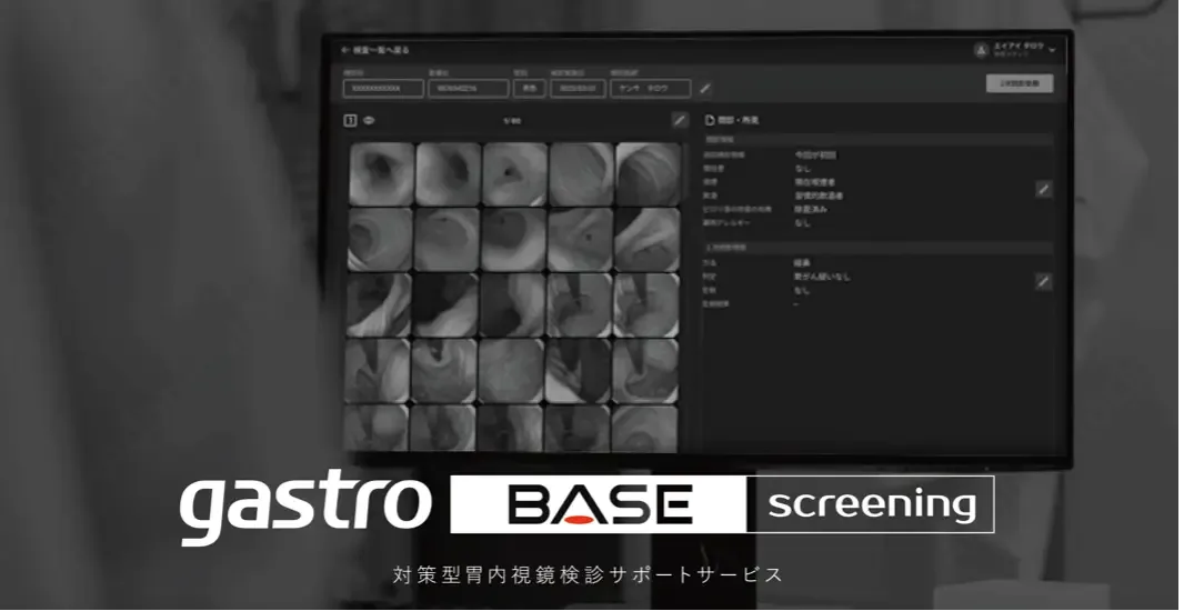 AIメディカルサービス、検診業務をクラウドでDX化する 対策型胃内視鏡検診サポートサービス「gastroBASE screening」をリリース　#IVSPRWeek